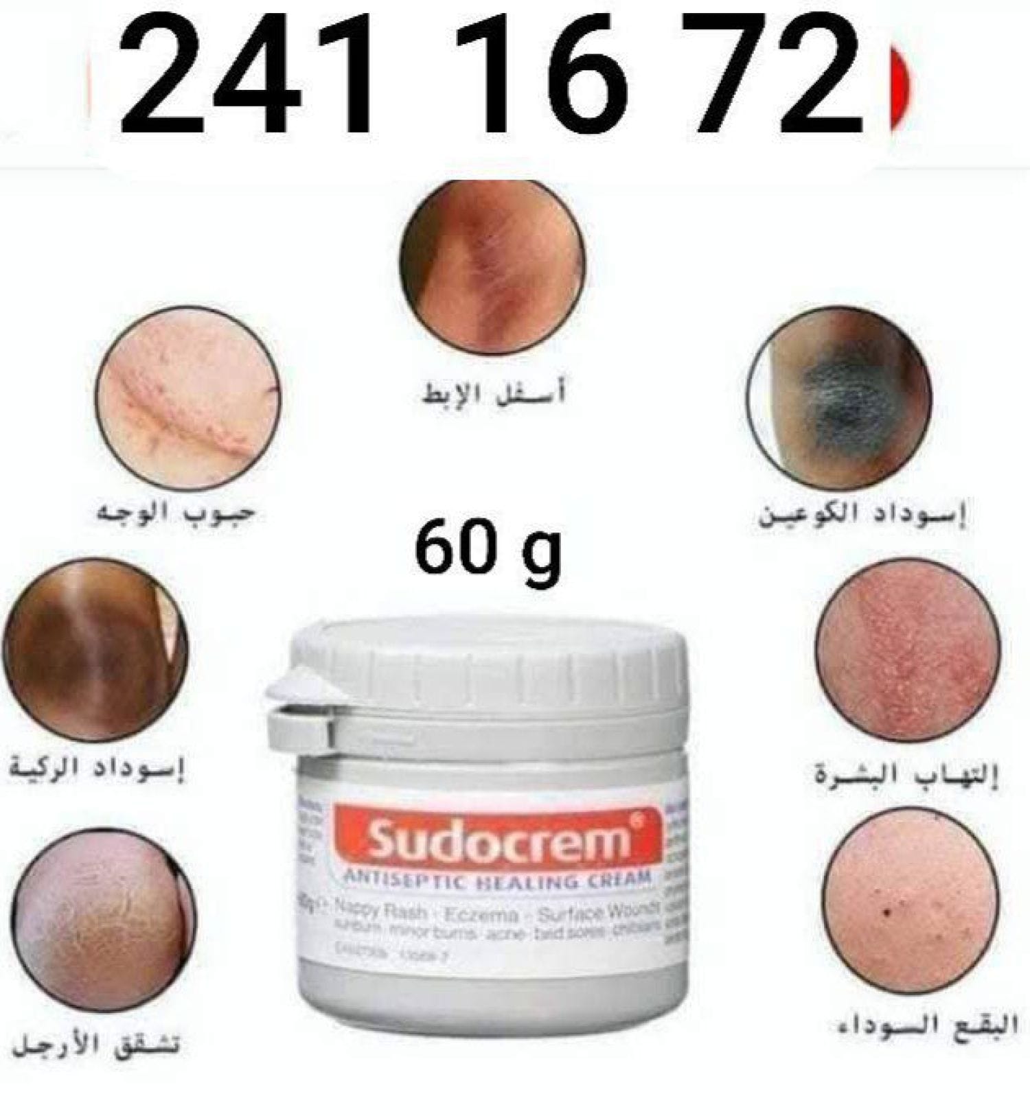 كريم sudocrem